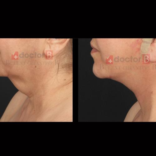 Before after photos of our patients 6